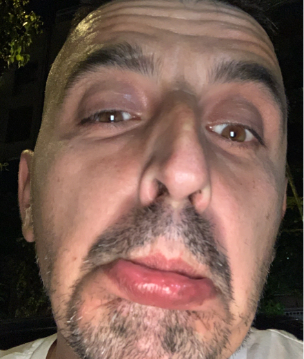 franjaroro